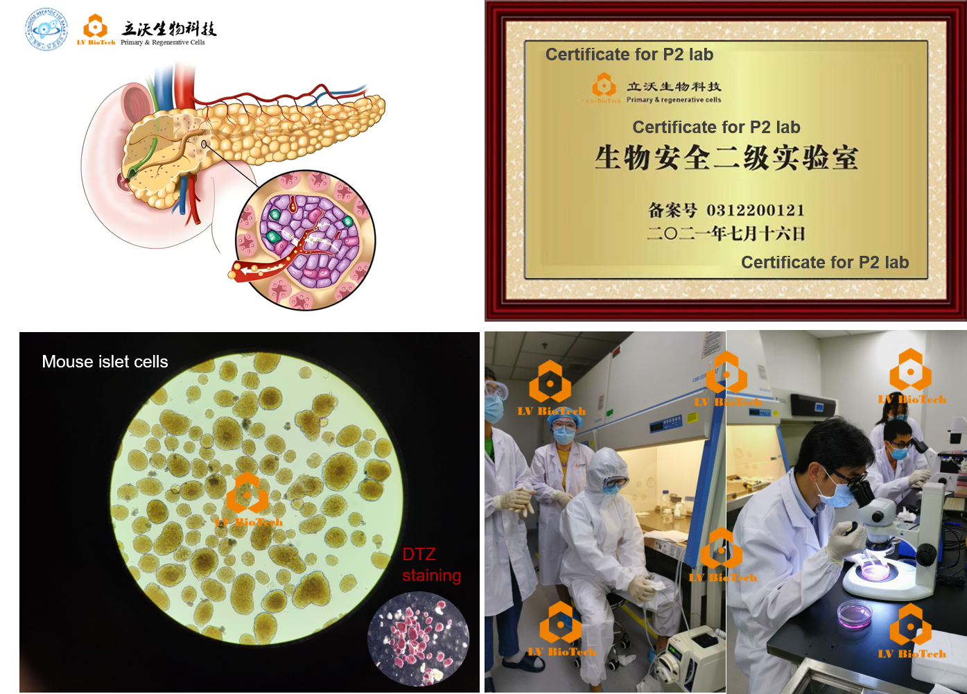 islet cells.png